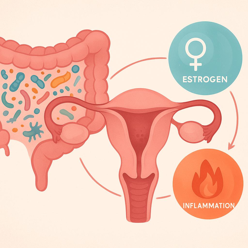Medical illustration of the gut microbiome beside a uterus and ovaries, with arrows linking microbes to an estrogen symbol and an inflammation flame icon to depict how microbiome, estrogen, and endometriosis-related inflammation are connected.