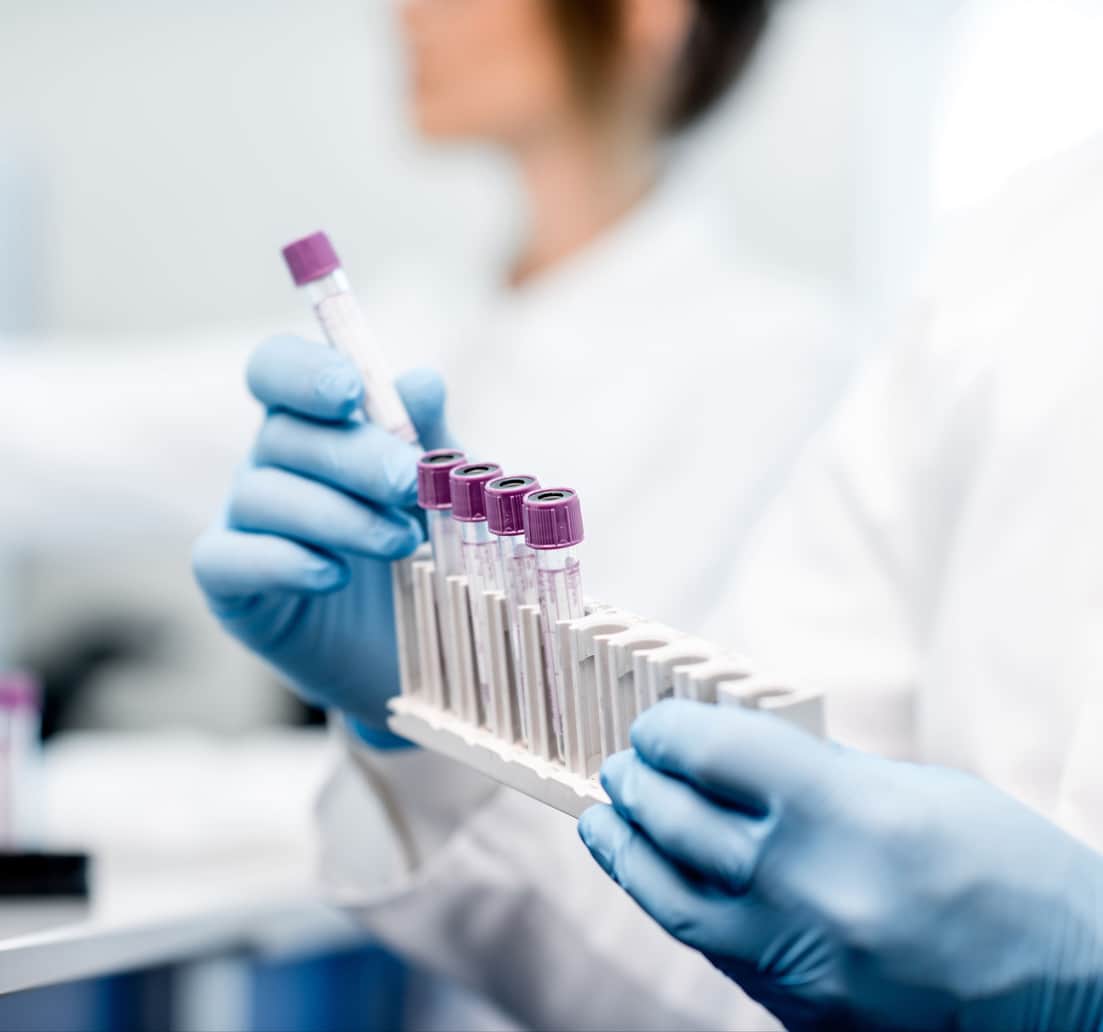 Laboratory assistant putting test tubes into the holder, Close-up view focused on the tubes 